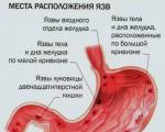 What can unpleasant bloating and heaviness in the stomach indicate?